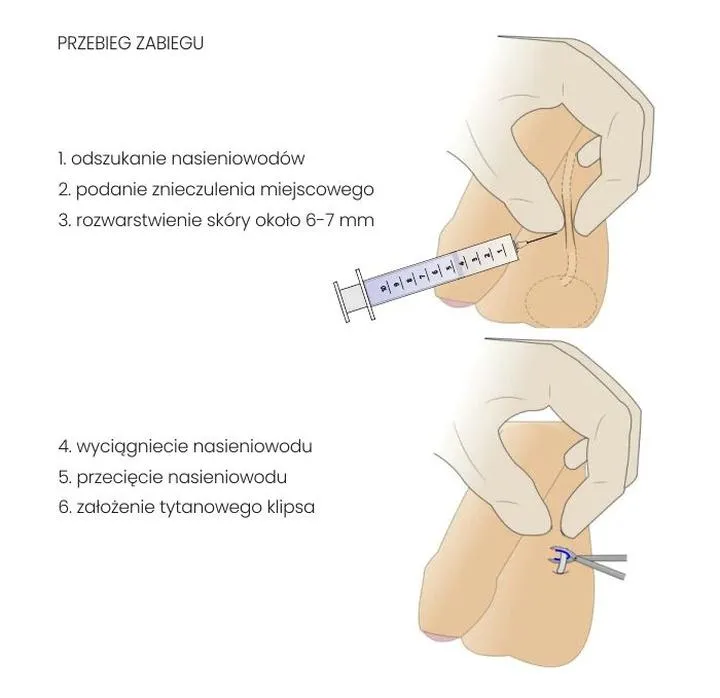 Moralne dylematy: Czy wazektomia jest grzechem według nauk Kościoła katolickiego?