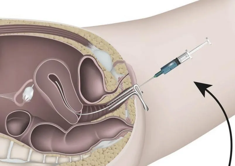 Inseminacja a moralność