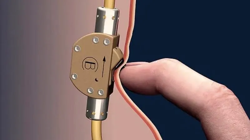 Kościół a antykoncepcja